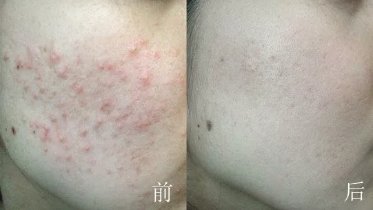 1626833544260623.png 微信圖片_20210721101221.png